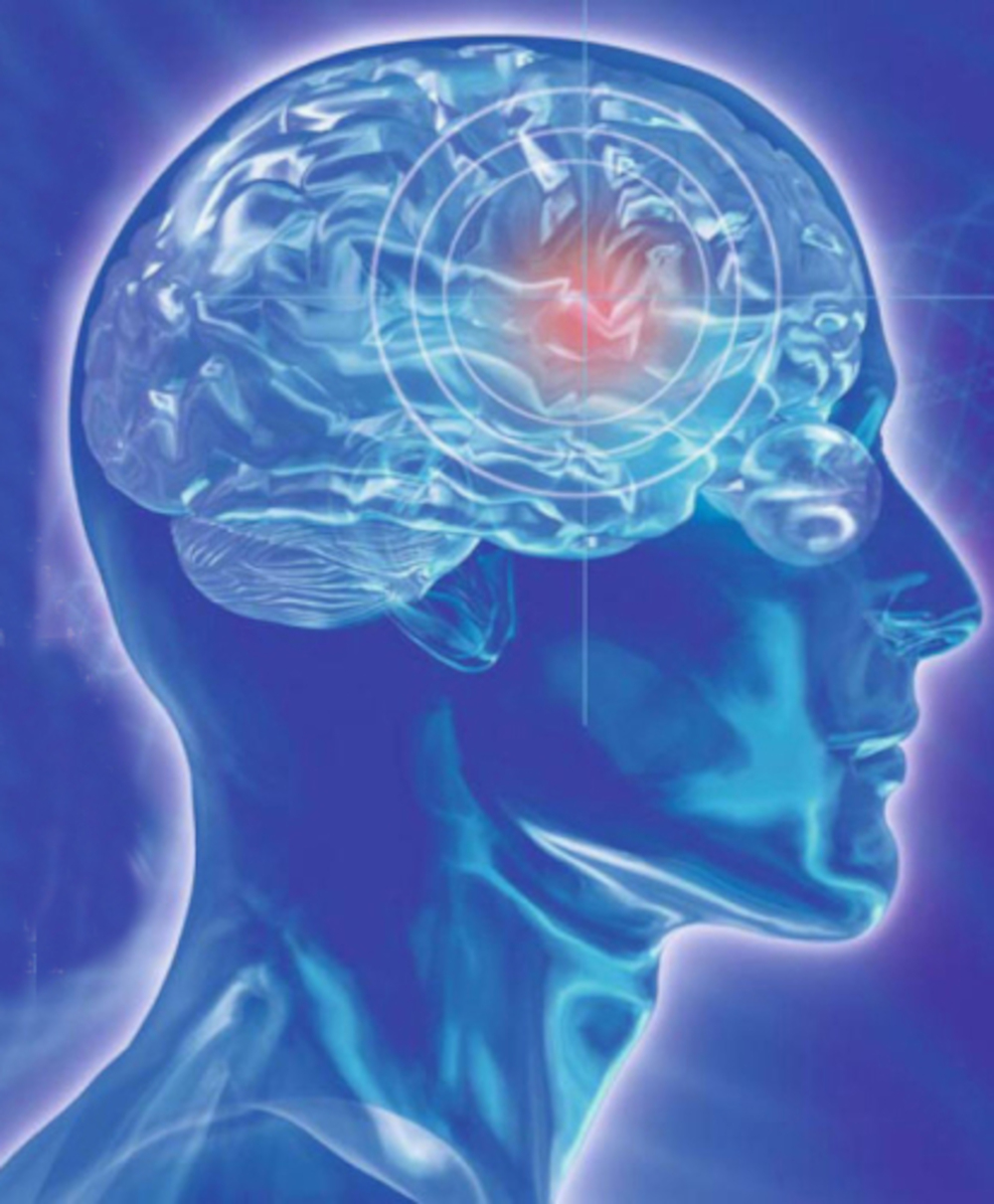 Wie ein niedriger Cholesterinspiegel Schlaganfällen vorbeugen kann