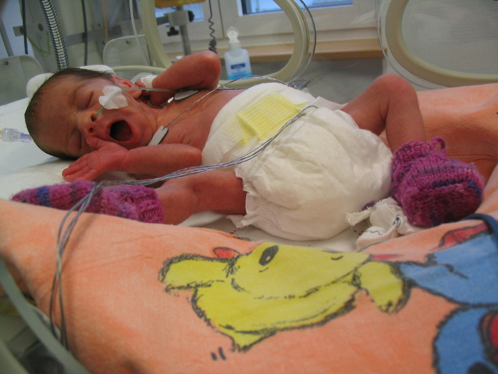 Klinikum Konstanz macht mit beim Welt Frühgeborenen Tag