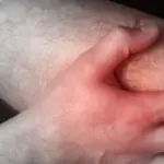 Schmerz im Unterschenkel