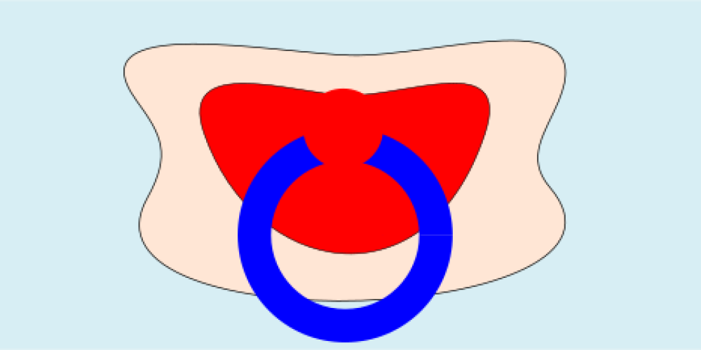 Geburtenrekord in der Frauenklinik Rheinfelden/Schweiz