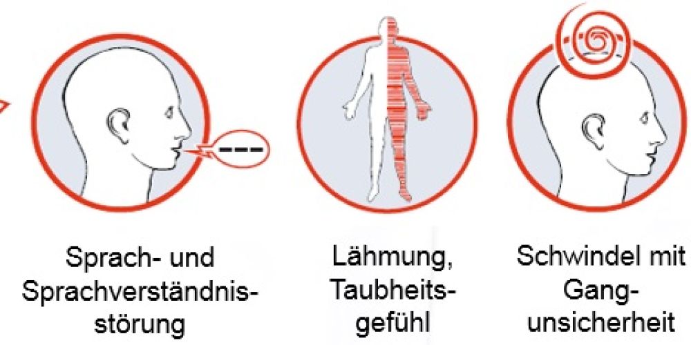 Schlaganfall vorbeugen