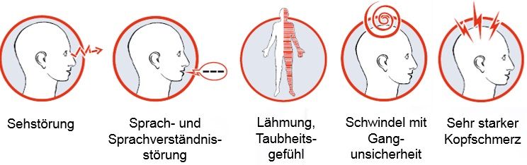Schlaganfall vorbeugen