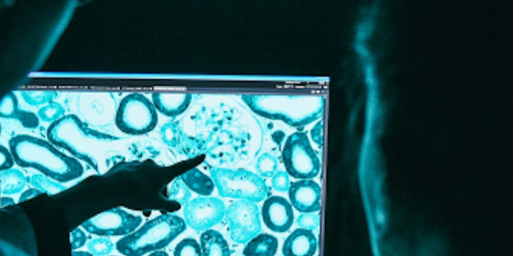 Entzündungen besser verstehen