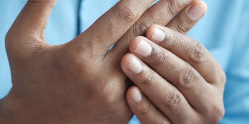 CBD hat sich bei vielen Gesundheitszuständen, als nützlich erwiesen.