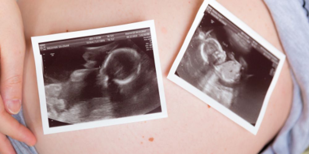 Neue Studie zum Thema Frühgeburtenrate