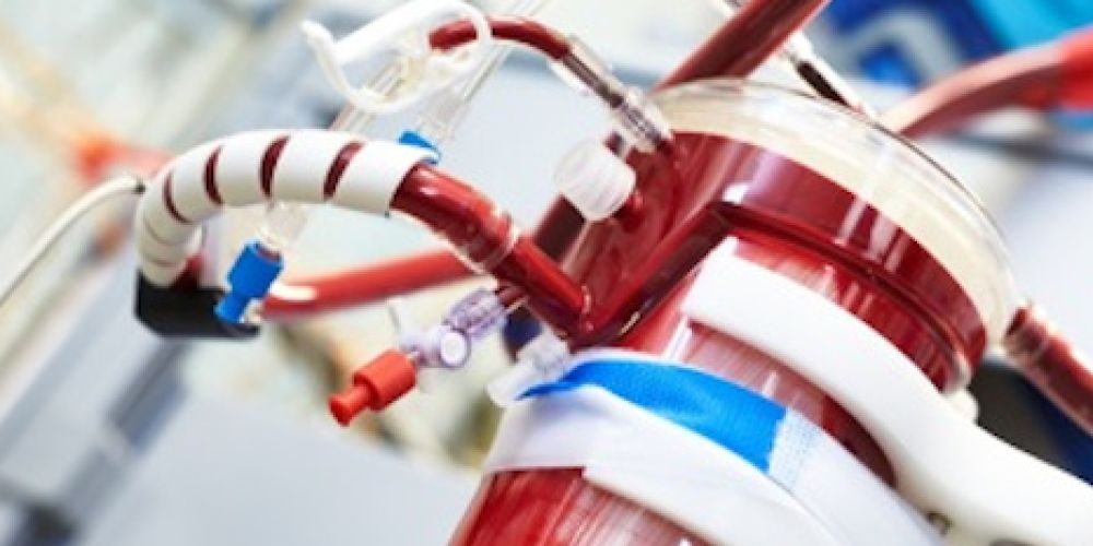 Die "künstliche Lunge" als letzte Hoffnung